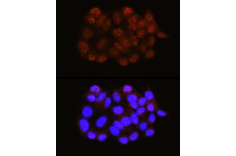 Immunofluorescence - Anti-NRBF2 Antibody (A9878) - Antibodies.com