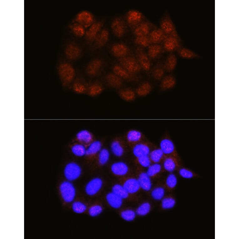 Immunofluorescence - Anti-NRBF2 Antibody (A9878) - Antibodies.com