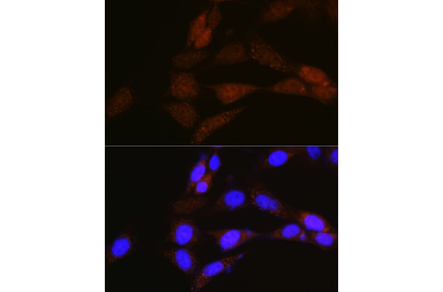 Immunofluorescence - Anti-NRBF2 Antibody (A9878) - Antibodies.com