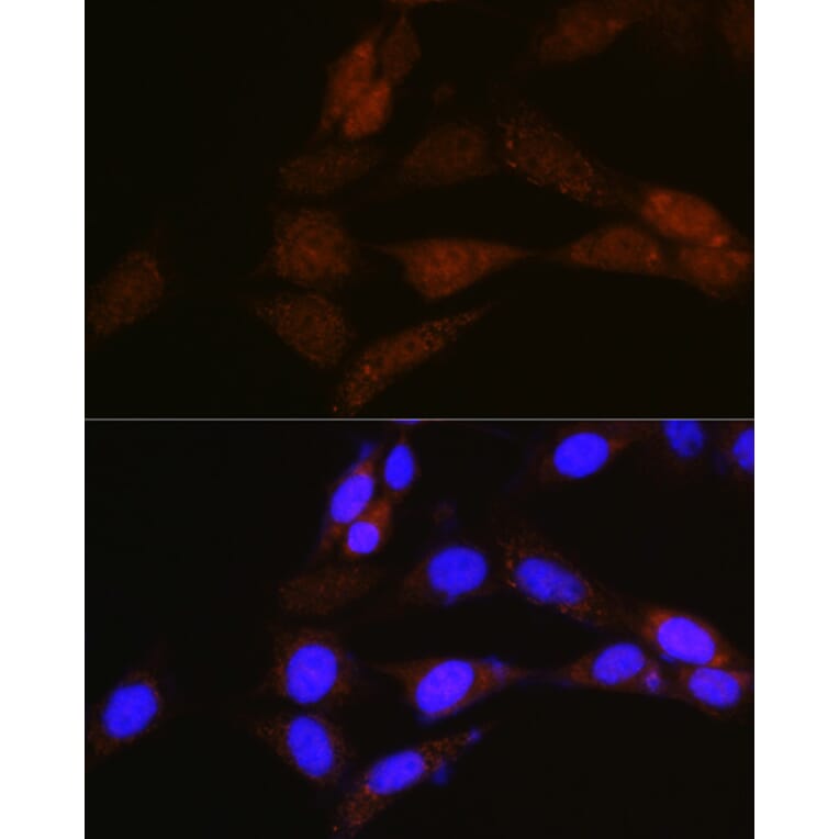 Immunofluorescence - Anti-NRBF2 Antibody (A9878) - Antibodies.com