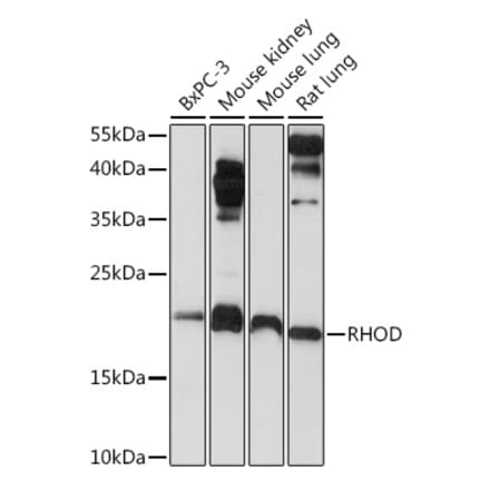 Western Blot - Anti-RHOD Antibody (A9879) - Antibodies.com