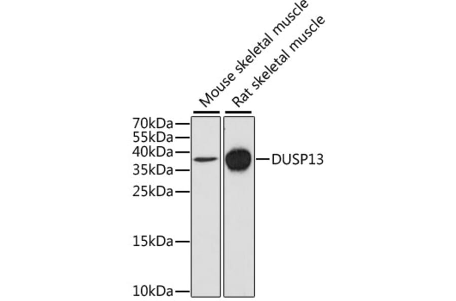 Western Blot - Anti-DUSP13 Antibody (A9880) - Antibodies.com