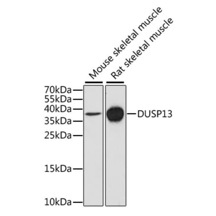 Western Blot - Anti-DUSP13 Antibody (A9880) - Antibodies.com