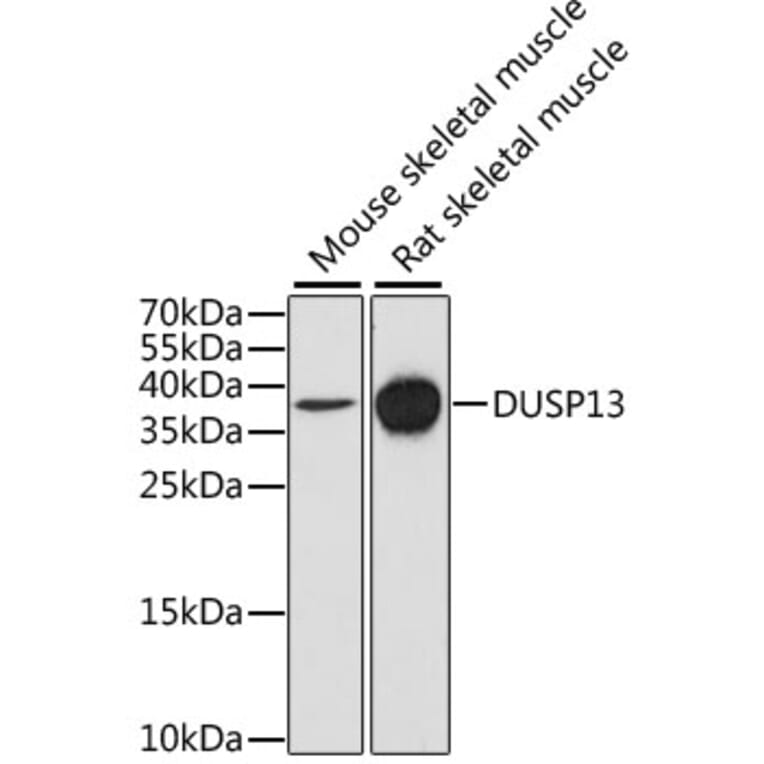 Western Blot - Anti-DUSP13 Antibody (A9880) - Antibodies.com
