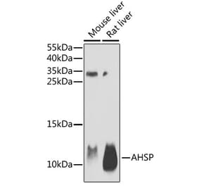 Western Blot - Anti-Ahsp Antibody (A9881) - Antibodies.com