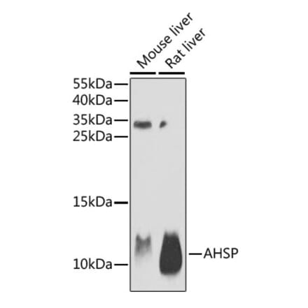 Western Blot - Anti-Ahsp Antibody (A9881) - Antibodies.com