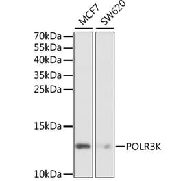 Western Blot - Anti-POLR3K Antibody (A6467) - Antibodies.com