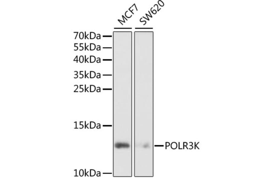 Western Blot - Anti-POLR3K Antibody (A6467) - Antibodies.com