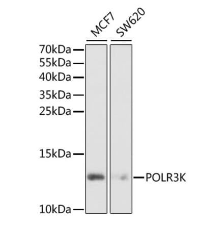 Western Blot - Anti-POLR3K Antibody (A6467) - Antibodies.com