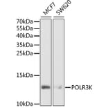 Western Blot - Anti-POLR3K Antibody (A6467) - Antibodies.com