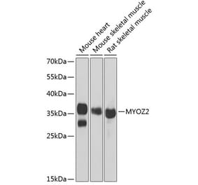 Western Blot - Anti-Myozenin 2 Antibody (A9883) - Antibodies.com
