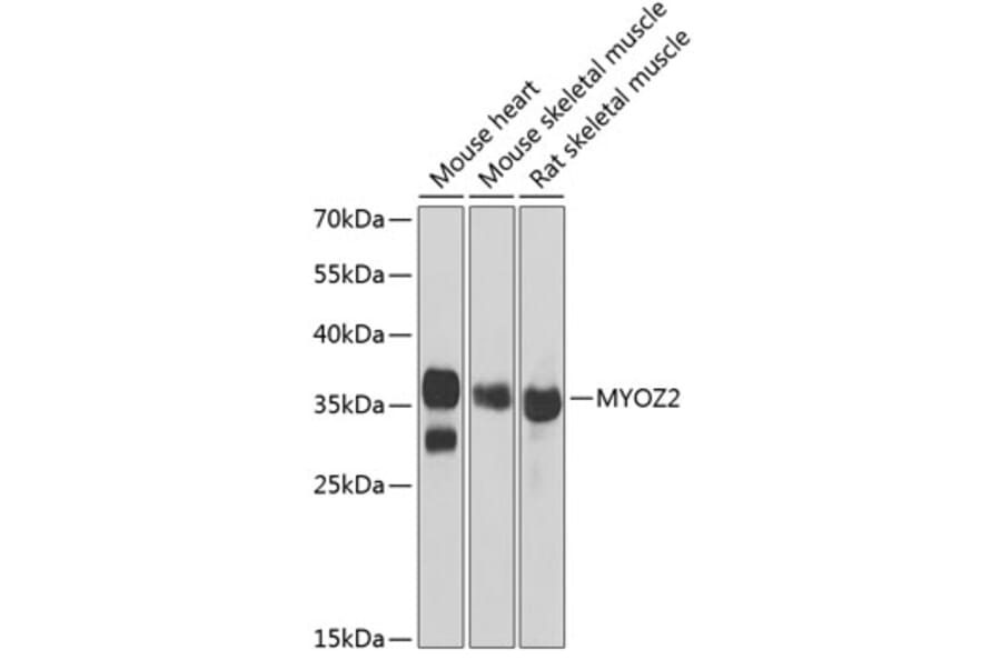 Western Blot - Anti-Myozenin 2 Antibody (A9883) - Antibodies.com