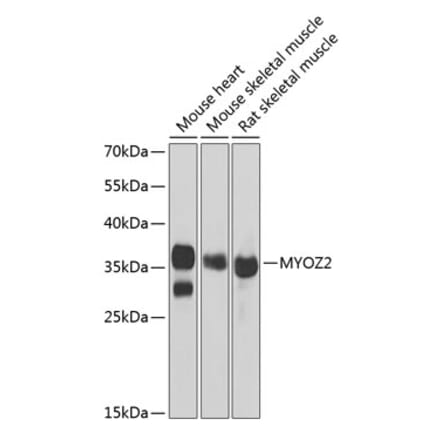 Western Blot - Anti-Myozenin 2 Antibody (A9883) - Antibodies.com