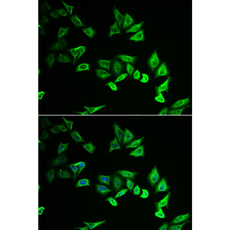 Immunofluorescence - Anti-Myozenin 2 Antibody (A9883) - Antibodies.com