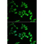 Immunofluorescence - Anti-Myozenin 2 Antibody (A9883) - Antibodies.com