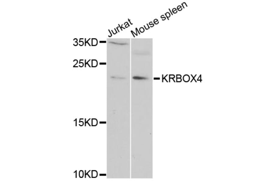Western Blot - Anti-KRBOX4 Antibody (A6471) - Antibodies.com