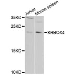 Western Blot - Anti-KRBOX4 Antibody (A6471) - Antibodies.com