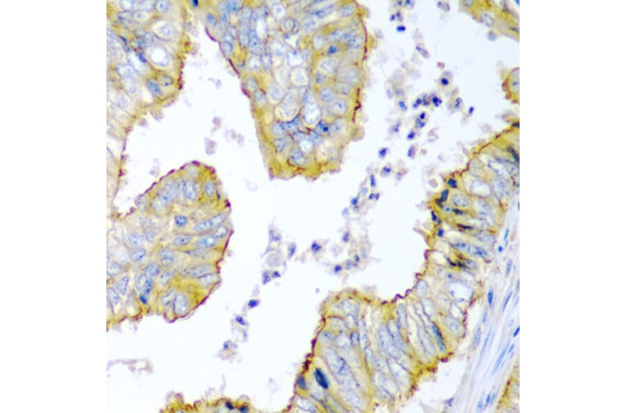 Immunohistochemistry - Anti-KRBOX4 Antibody (A6471) - Antibodies.com