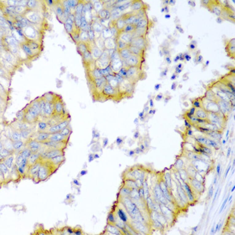 Immunohistochemistry - Anti-KRBOX4 Antibody (A6471) - Antibodies.com