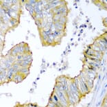 Immunohistochemistry - Anti-KRBOX4 Antibody (A6471) - Antibodies.com