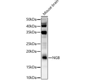 Western Blot - Anti-Neuroglobin Antibody (A9885) - Antibodies.com
