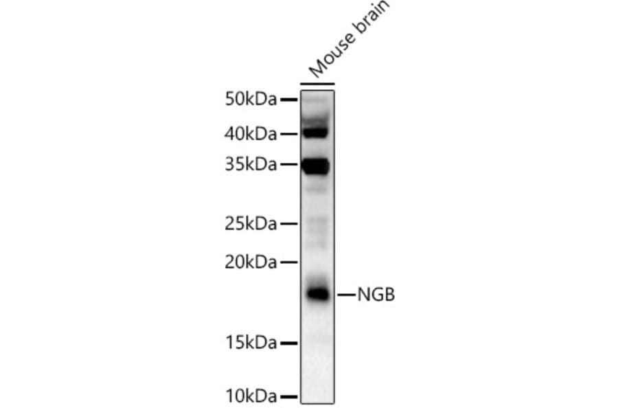 Western Blot - Anti-Neuroglobin Antibody (A9885) - Antibodies.com