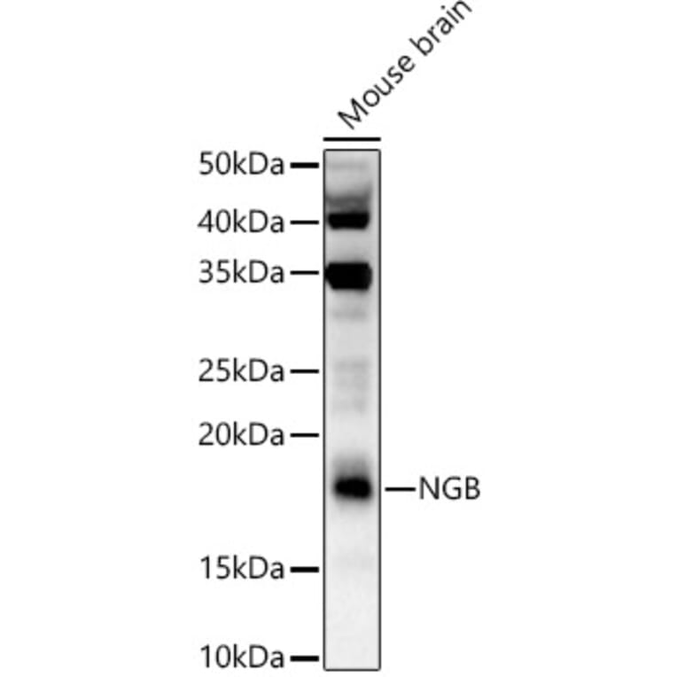 Western Blot - Anti-Neuroglobin Antibody (A9885) - Antibodies.com