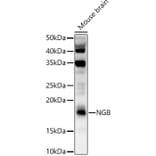 Western Blot - Anti-Neuroglobin Antibody (A9885) - Antibodies.com