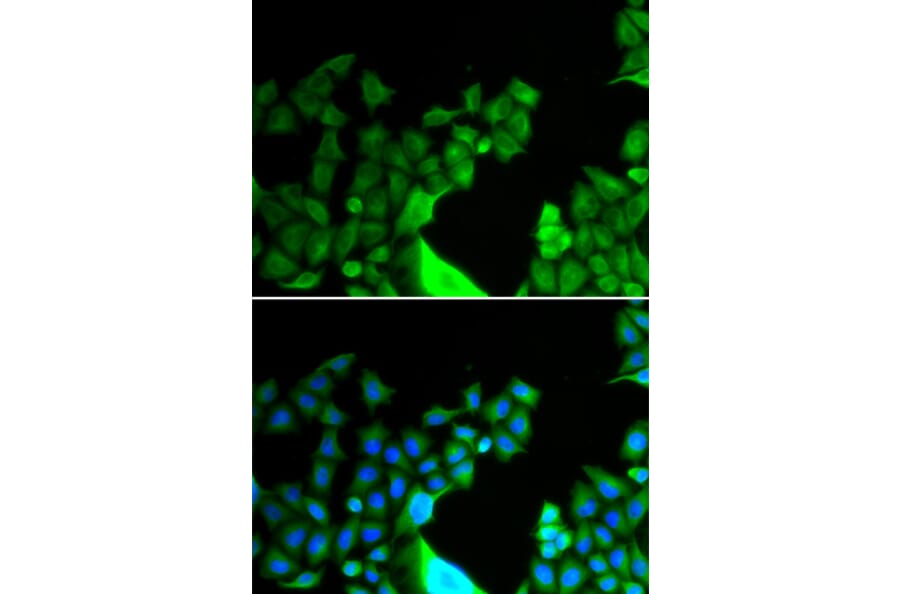 Immunofluorescence - Anti-Bcl G/BCL2L14 Antibody (A9886) - Antibodies.com
