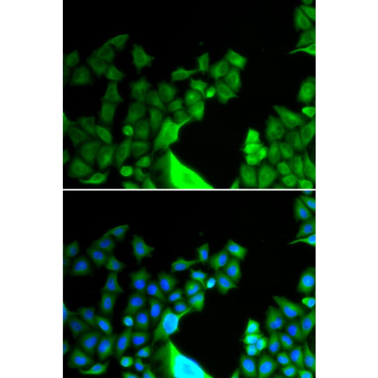 Immunofluorescence - Anti-Bcl G/BCL2L14 Antibody (A9886) - Antibodies.com