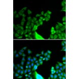 Immunofluorescence - Anti-Bcl G/BCL2L14 Antibody (A9886) - Antibodies.com