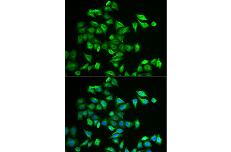 Immunofluorescence - Anti-POMGNT2 Antibody (A6484) - Antibodies.com