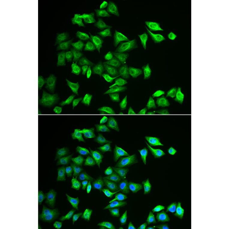 Immunofluorescence - Anti-POMGNT2 Antibody (A6484) - Antibodies.com