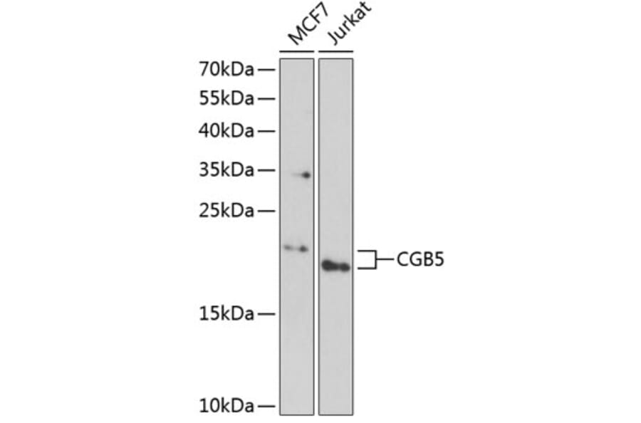 Western Blot - Anti-Choriogonadotropin subunit beta 3 Antibody (A9890) - Antibodies.com
