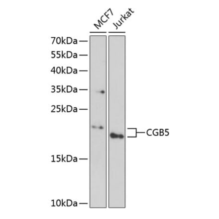 Western Blot - Anti-Choriogonadotropin subunit beta 3 Antibody (A9890) - Antibodies.com