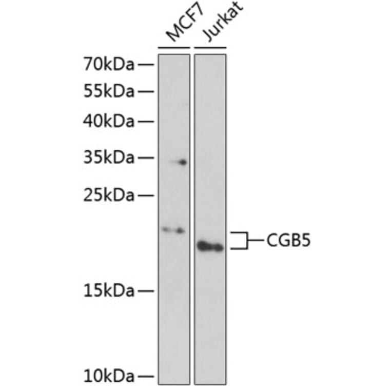 Western Blot - Anti-Choriogonadotropin subunit beta 3 Antibody (A9890) - Antibodies.com