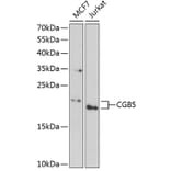 Western Blot - Anti-Choriogonadotropin subunit beta 3 Antibody (A9890) - Antibodies.com