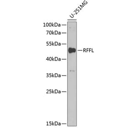 Western Blot - Anti-Rffl Antibody (A9891) - Antibodies.com