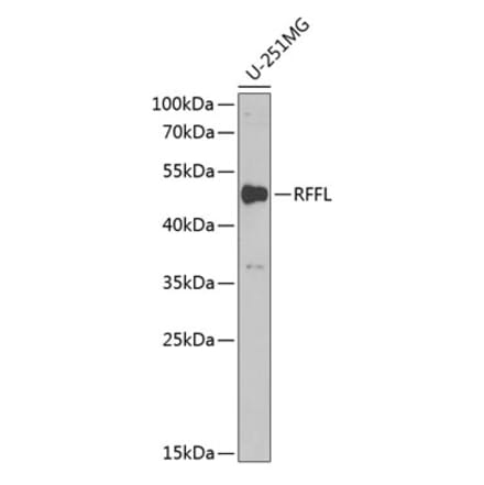 Western Blot - Anti-Rffl Antibody (A9891) - Antibodies.com