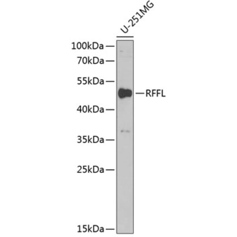 Western Blot - Anti-Rffl Antibody (A9891) - Antibodies.com