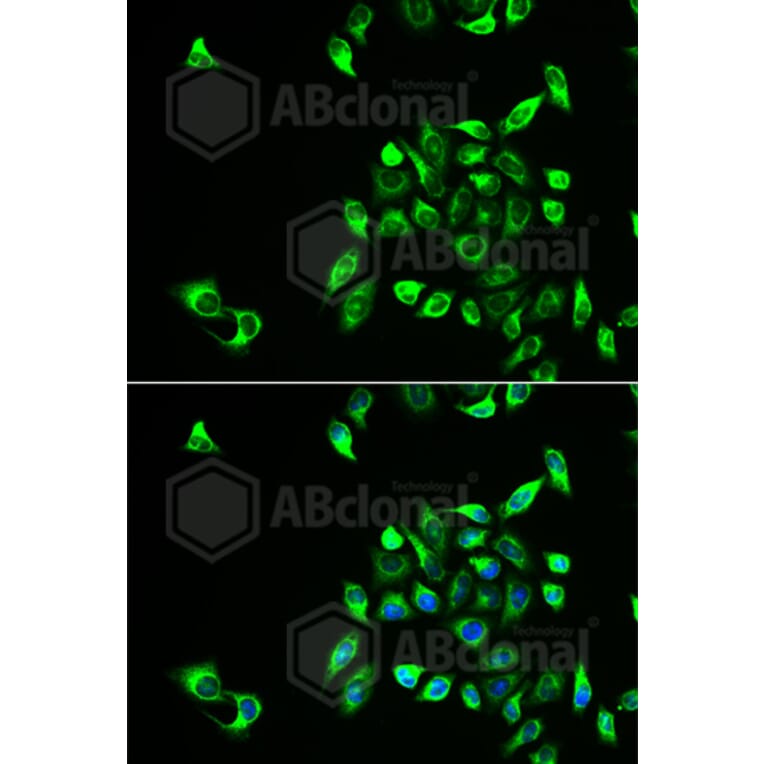 Immunofluorescence - Anti-CSNK1A1L Antibody (A6490) - Antibodies.com