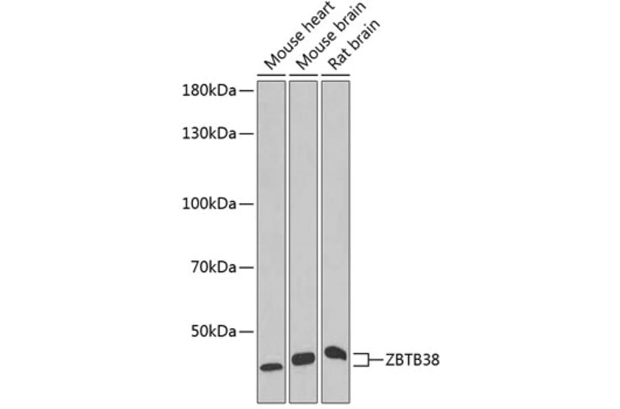 Western Blot - Anti-ZBTB38 Antibody (A6494) - Antibodies.com