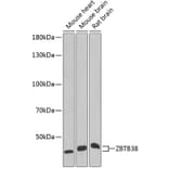 Western Blot - Anti-ZBTB38 Antibody (A6494) - Antibodies.com