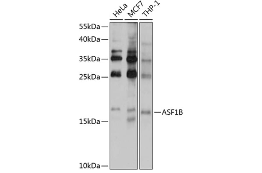 Western Blot - Anti-ASF1b Antibody (A9897) - Antibodies.com