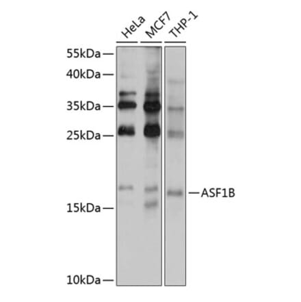 Western Blot - Anti-ASF1b Antibody (A9897) - Antibodies.com