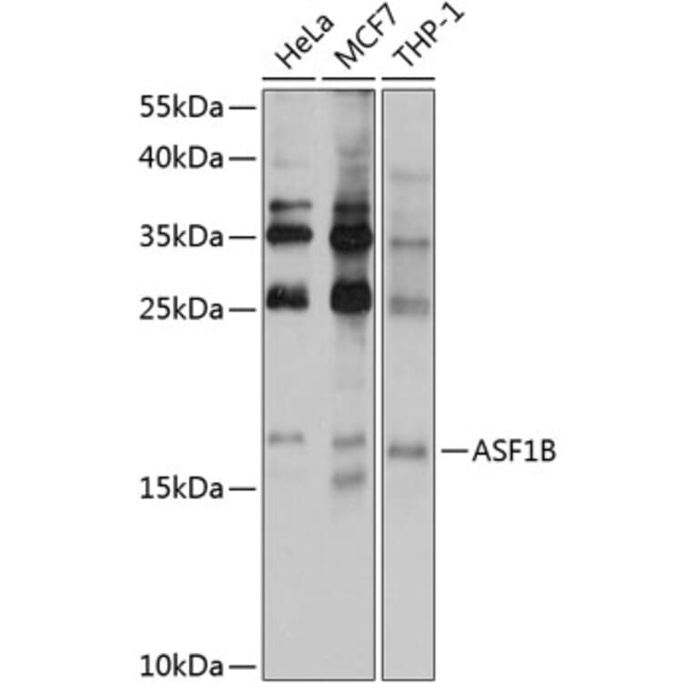 Western Blot - Anti-ASF1b Antibody (A9897) - Antibodies.com