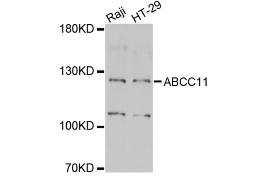 Western Blot - Anti-ABCC11 Antibody (A6514) - Antibodies.com