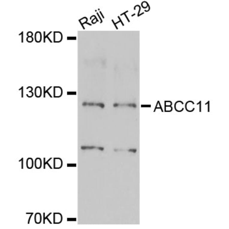 Western Blot - Anti-ABCC11 Antibody (A6514) - Antibodies.com