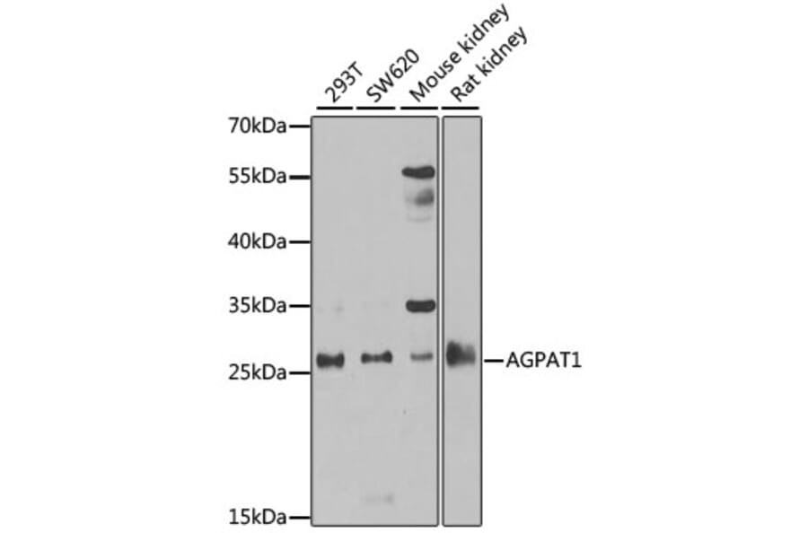 Western Blot - Anti-AGPAT1 Antibody (A9899) - Antibodies.com
