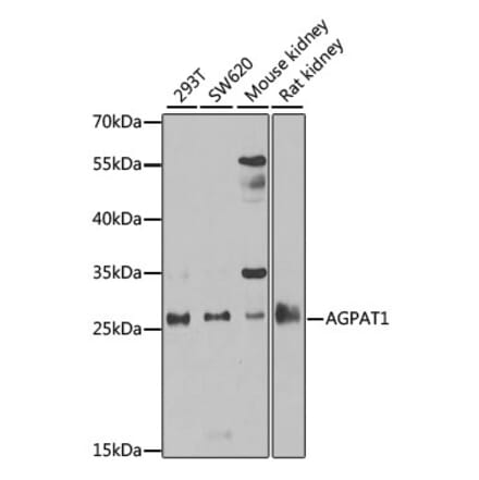 Western Blot - Anti-AGPAT1 Antibody (A9899) - Antibodies.com